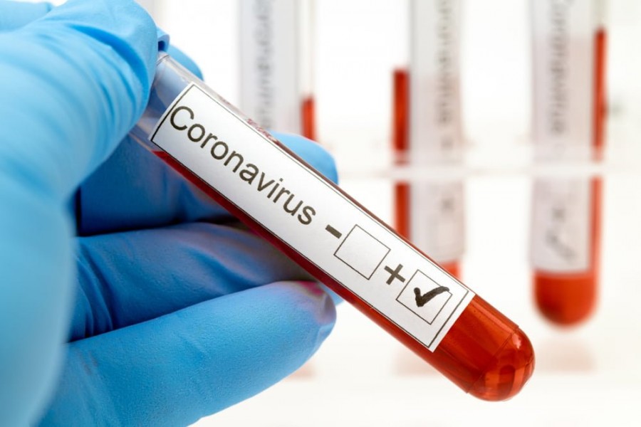 Coronavirus: 1.059 de noi cazuri, dintre care 19 la Arad