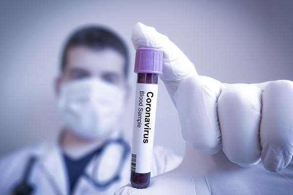 1.639 de noi cazuri de infectare cu COVID-19, dintre care 25 la Arad