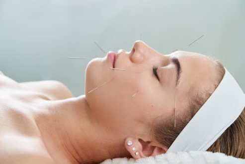 Acupunctura: O terapie milenară pentru echilibrul și vindecarea corpului și minții